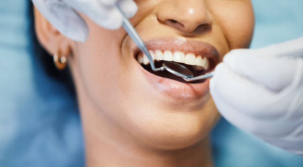 Best Walk-In Emergency Dental Services in Collinsville, VA